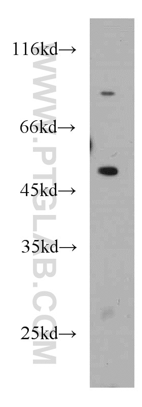 WB analysis of RAW264.7 using 21568-1-AP
