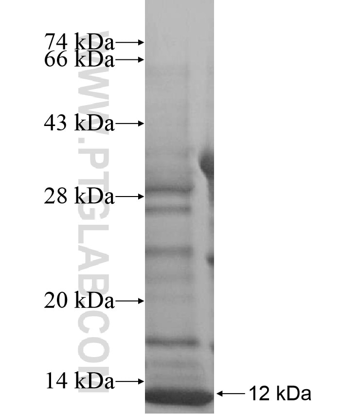 SLC25A25 fusion protein Ag17338 SDS-PAGE