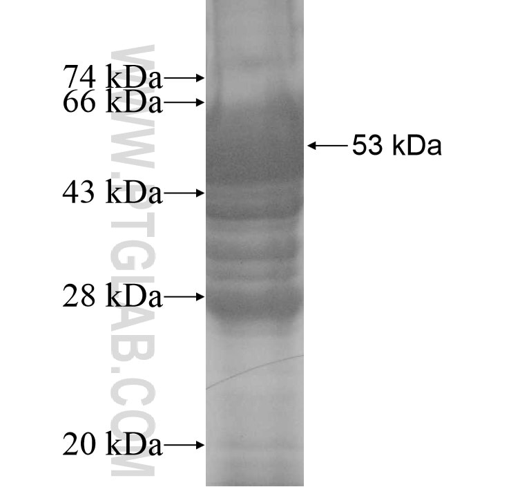 SLC25A27 fusion protein Ag10715 SDS-PAGE