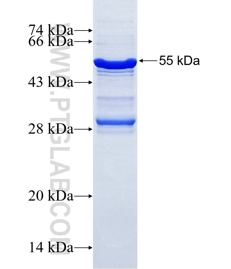 SLC25A27 fusion protein Ag10715 SDS-PAGE