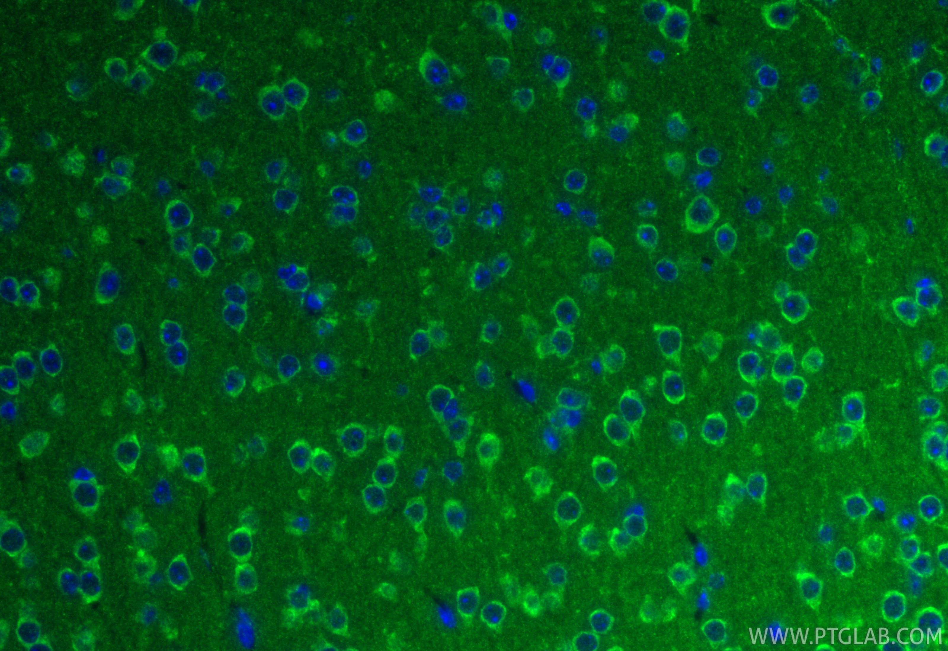 IF Staining of mouse brain using 26663-1-AP Immunofluorescence (IF) / fluorescent staining of mouse brain tissue using SLC25A29 Polyclonal antibody (26663-1-AP)