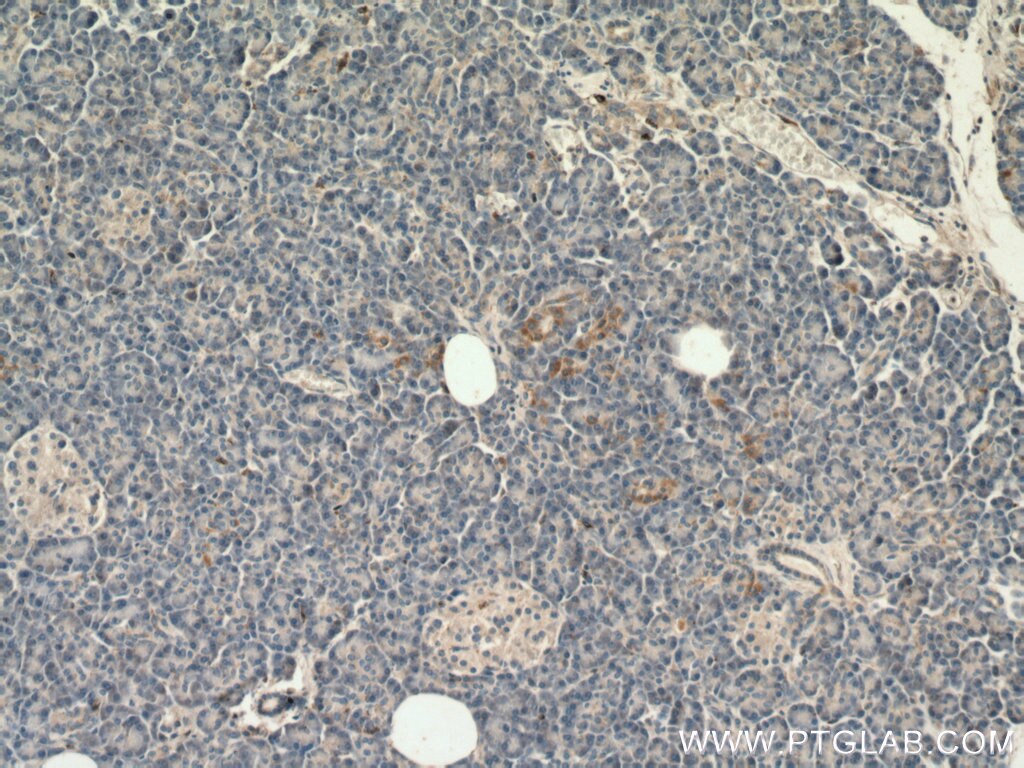 Immunohistochemistry (IHC) staining of human pancreas tissue using SLC25A29 Polyclonal antibody (26663-1-AP)