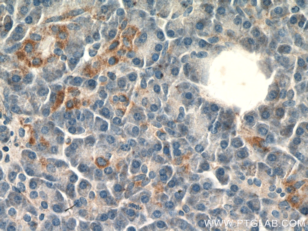 Immunohistochemistry (IHC) staining of human pancreas tissue using SLC25A29 Polyclonal antibody (26663-1-AP)