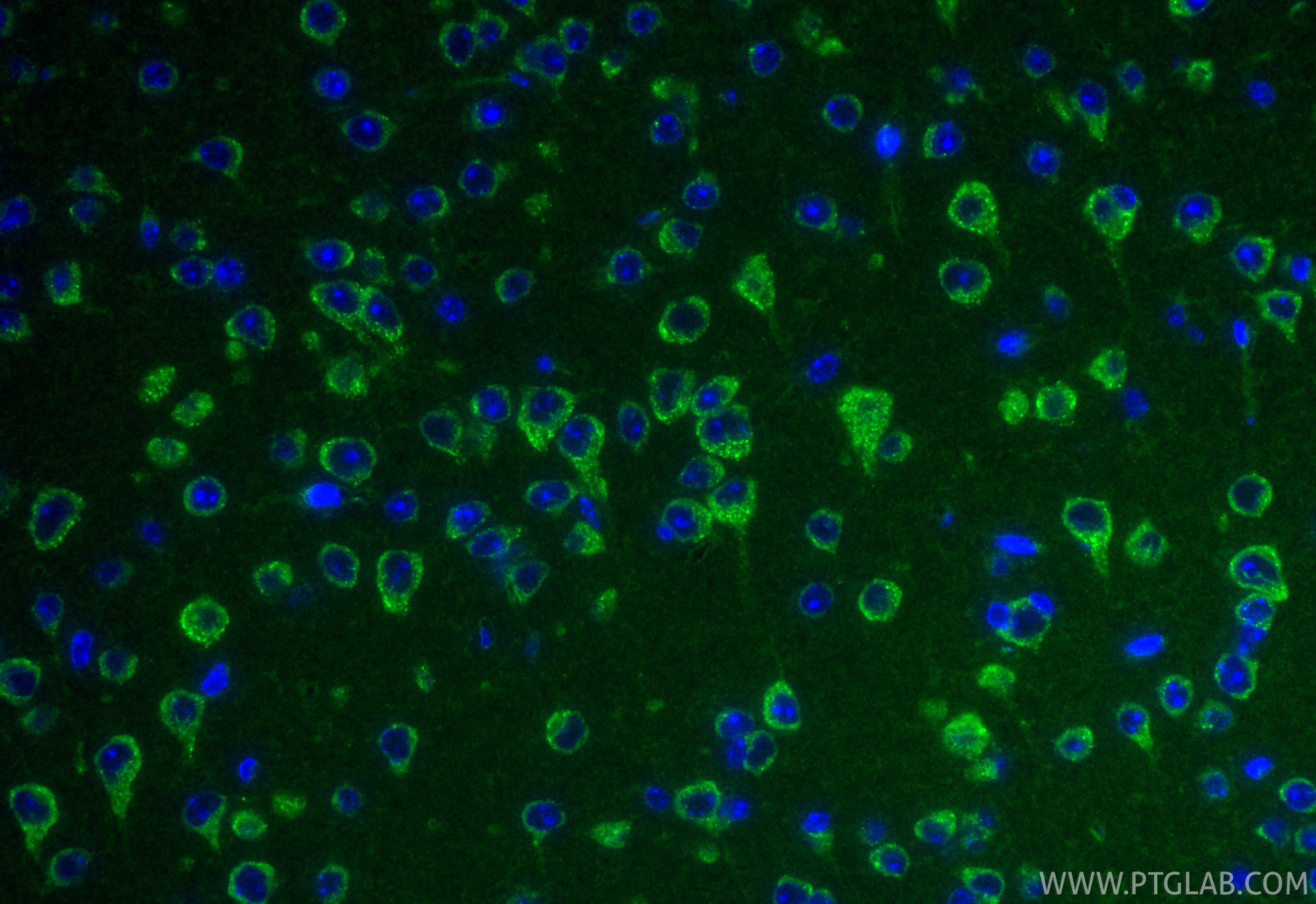 IF Staining of mouse brain using 87551-1-RR (same clone as 87551-1-PBS) Immunofluorescence (IF) / fluorescent staining of mouse brain tissue using SLC25A29 Recombinant monoclonal antibody (87551-1-RR)