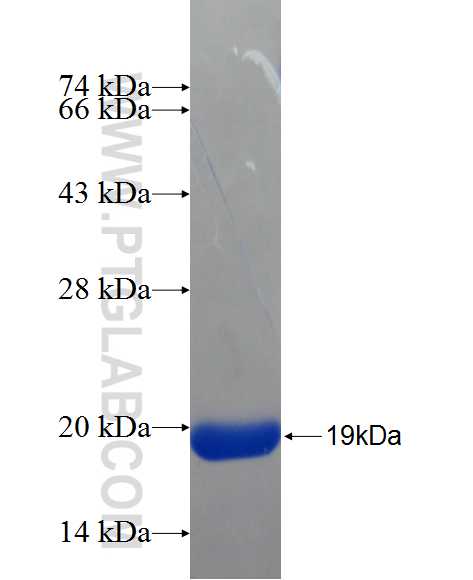 SLC25A29 fusion protein Ag24662 SDS-PAGE