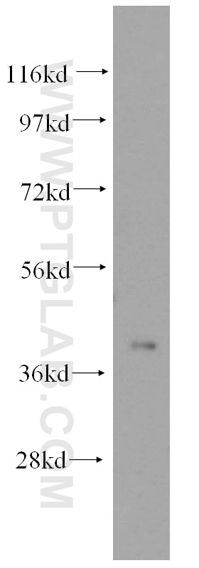 WB analysis of mouse pancreas using 15855-1-AP