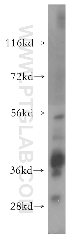 Western Blot (WB) analysis of MCF-7 cells using SLC25A3 Polyclonal antibody (15855-1-AP)