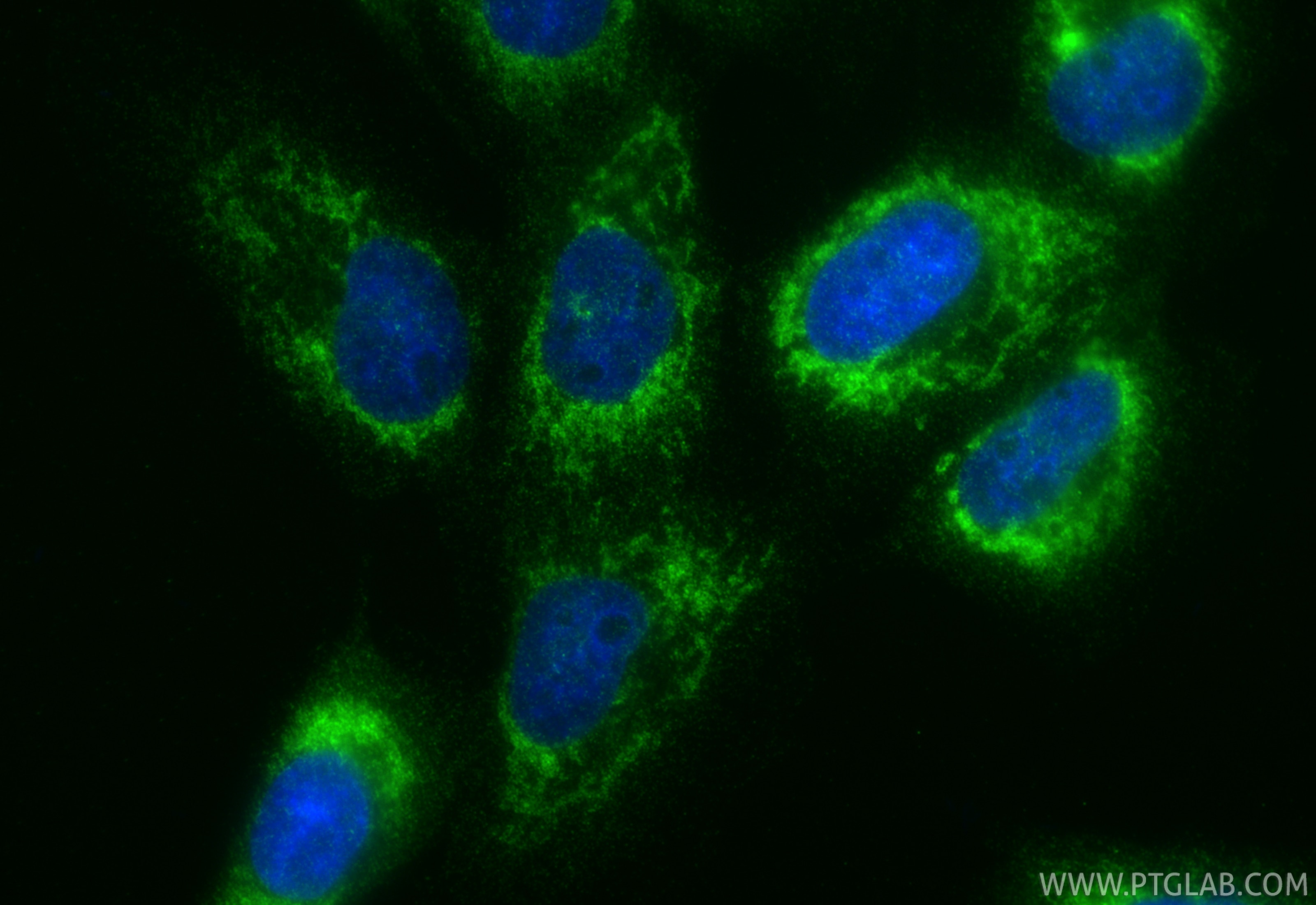 Immunofluorescence (IF) / fluorescent staining of U-251 cells using SLC25A31/ANT4 Polyclonal antibody (33263-1-AP)