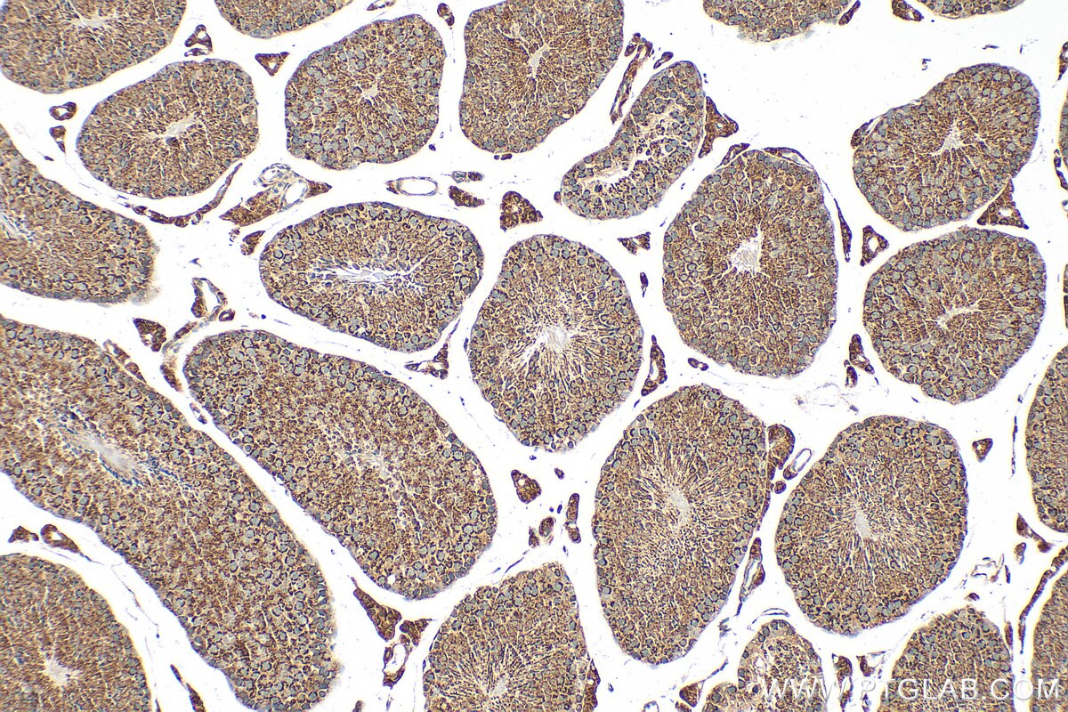 Immunohistochemistry (IHC) staining of mouse testis tissue using SLC25A31/ANT4 Polyclonal antibody (33263-1-AP)
