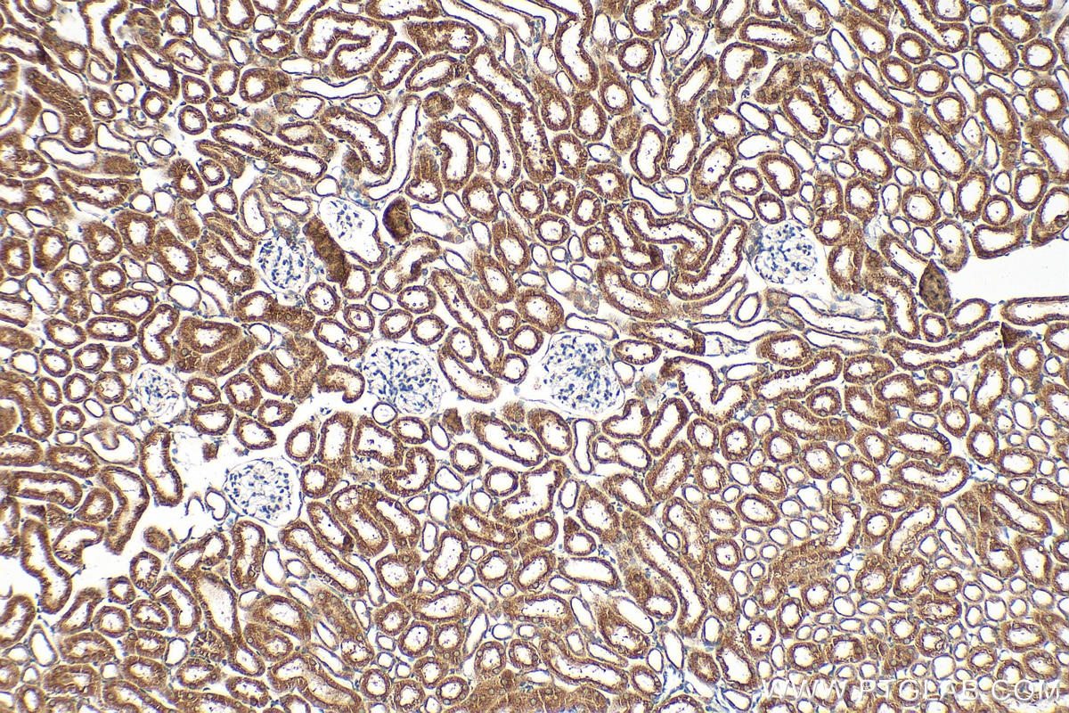 Immunohistochemistry (IHC) staining of mouse kidney tissue using SLC25A31/ANT4 Polyclonal antibody (33263-1-AP)