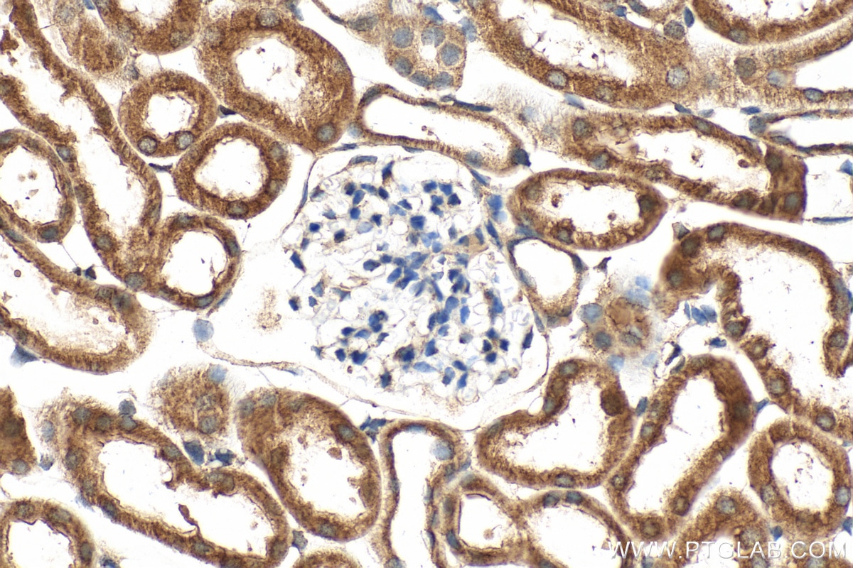 Immunohistochemistry (IHC) staining of mouse kidney tissue using SLC25A31/ANT4 Polyclonal antibody (33263-1-AP)