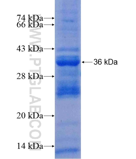 SLC25A31 fusion protein Ag21127 SDS-PAGE SLC25A31 fusion protein Ag21127 SDS-PAGE