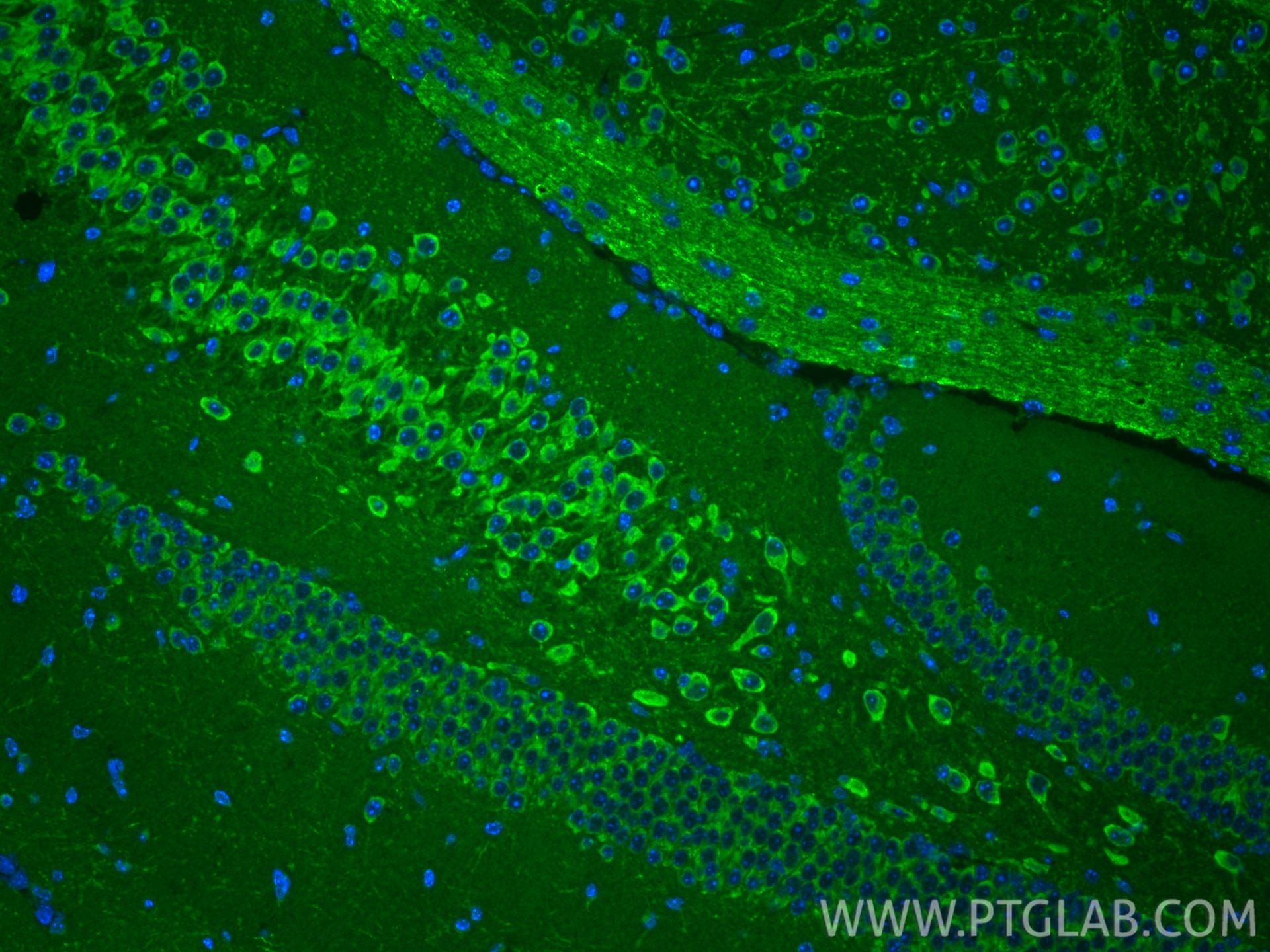 IF Staining of mouse brain using 13080-1-AP Immunofluorescence (IF) / fluorescent staining of mouse brain tissue using SLC25A32 Polyclonal antibody (13080-1-AP)