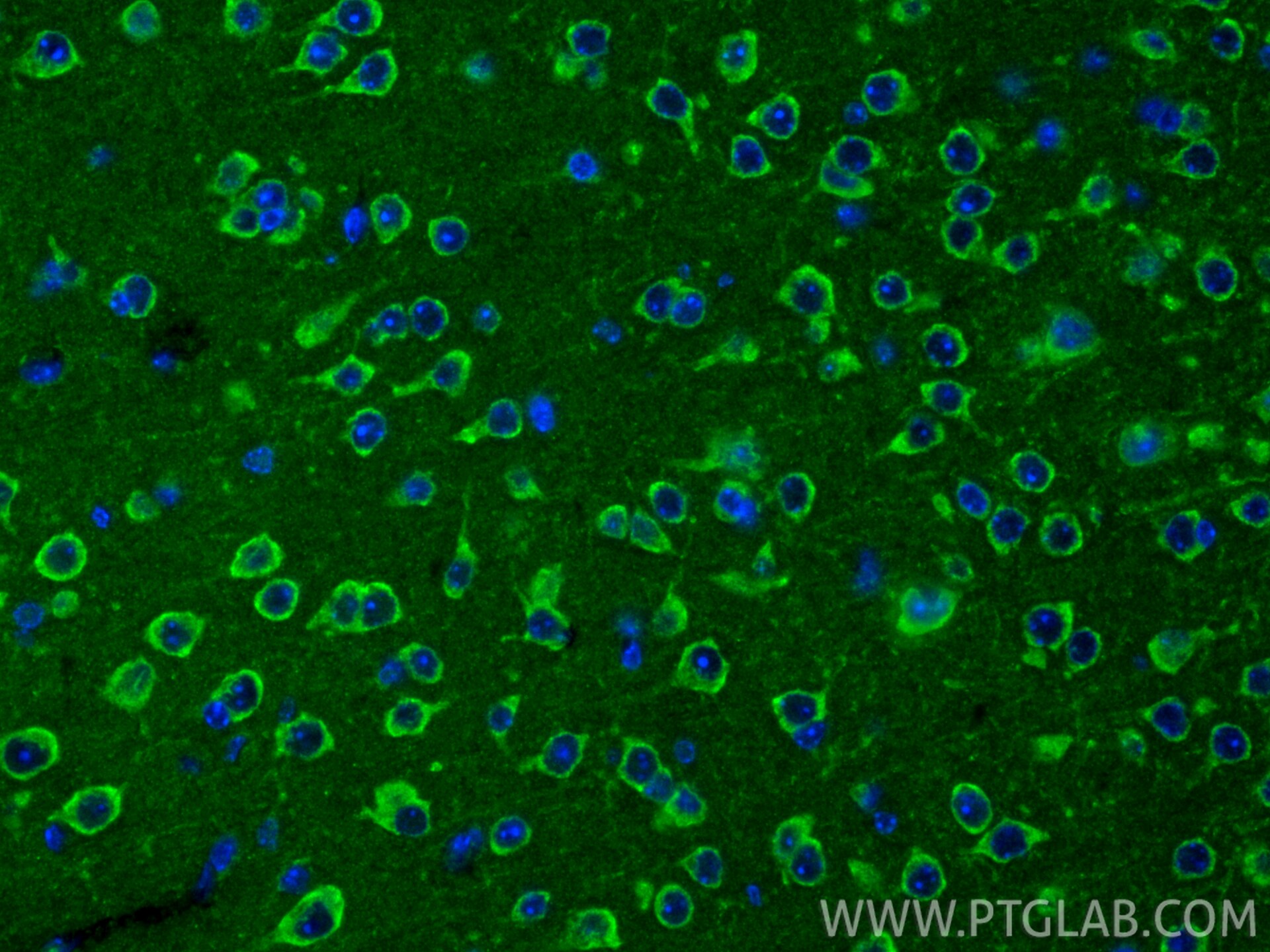 IF Staining of mouse brain using 13080-1-AP Immunofluorescence (IF) / fluorescent staining of mouse brain tissue using SLC25A32 Polyclonal antibody (13080-1-AP)