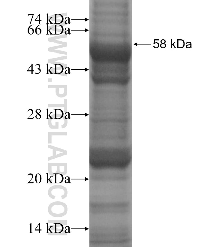 SLC25A32 fusion protein Ag3722 SDS-PAGE
