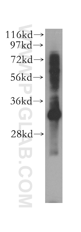 Western Blot (WB) analysis of human liver tissue using SLC25A34 Polyclonal antibody (17557-1-AP)