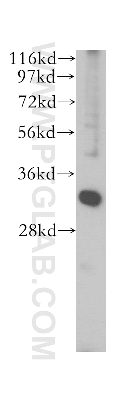 Western Blot (WB) analysis of HepG2 cells using SLC25A34 Polyclonal antibody (17557-1-AP)