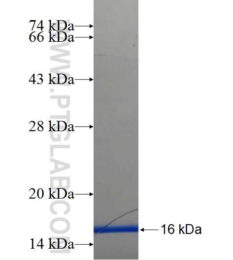 SLC25A36 fusion protein Ag23894 SDS-PAGE
