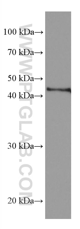 Western Blot (WB) analysis of LNCaP cells using Mitoferrin 1 Monoclonal antibody (67593-1-Ig)