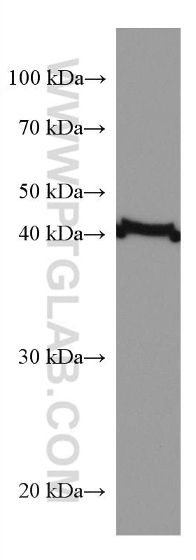 Western Blot (WB) analysis of HepG2 cells using Mitoferrin 1 Monoclonal antibody (67593-1-Ig)