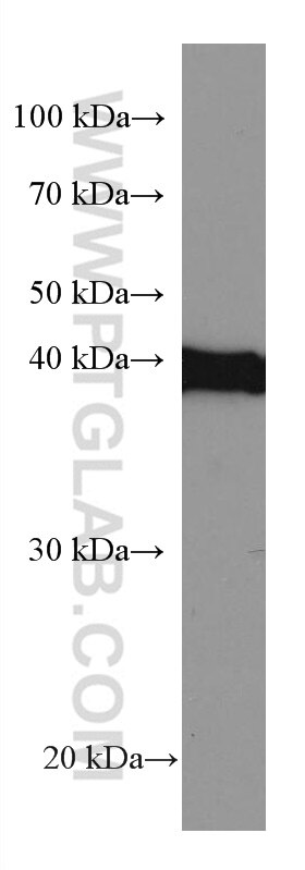 Western Blot (WB) analysis of TF-1 cells using Mitoferrin 1 Monoclonal antibody (67593-1-Ig)