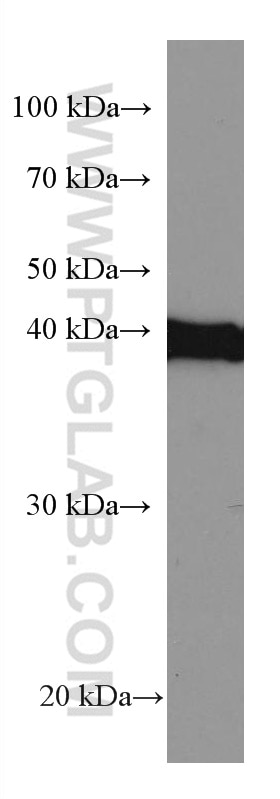 Western Blot (WB) analysis of TF-1 cells using Mitoferrin 1 Monoclonal antibody (67593-1-Ig)