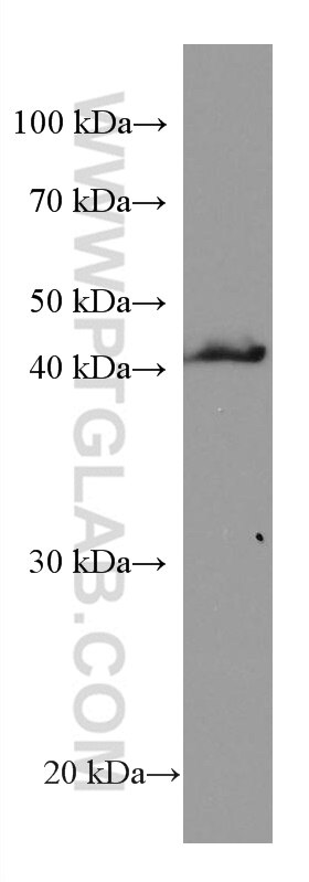 WB analysis of human spleen using 67593-1-Ig