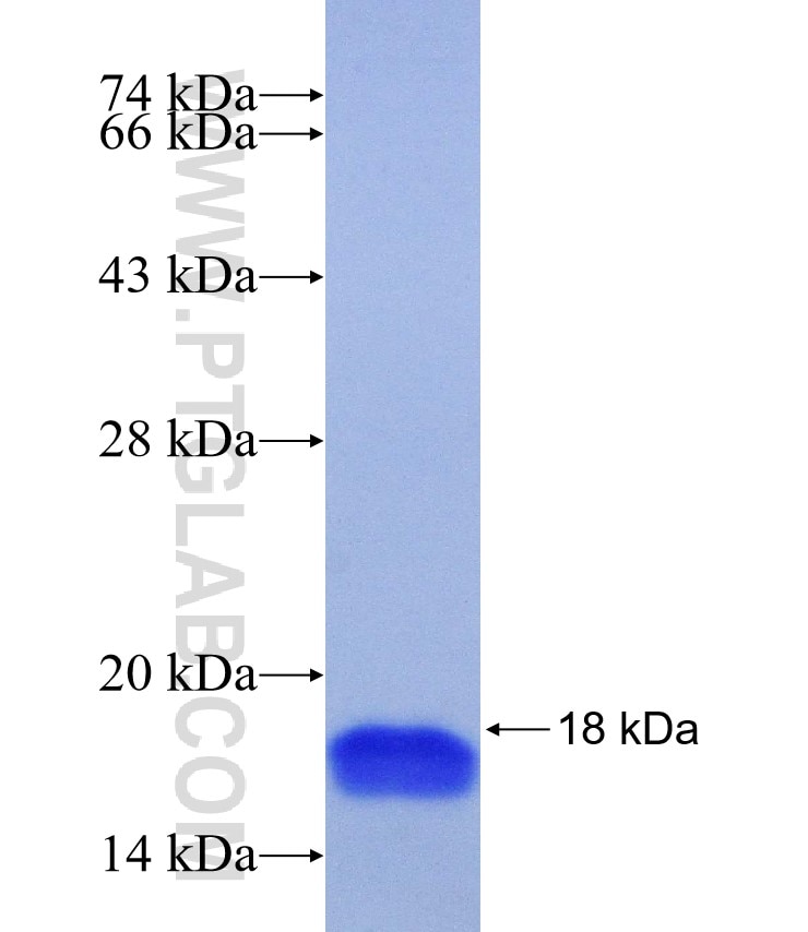 SLC25A37 fusion protein Ag26216 SDS-PAGE