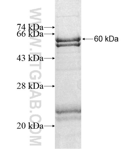 SLC25A38 fusion protein Ag10560 SDS-PAGE