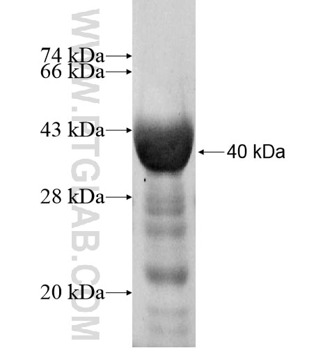 SLC25A38 fusion protein Ag10651 SDS-PAGE