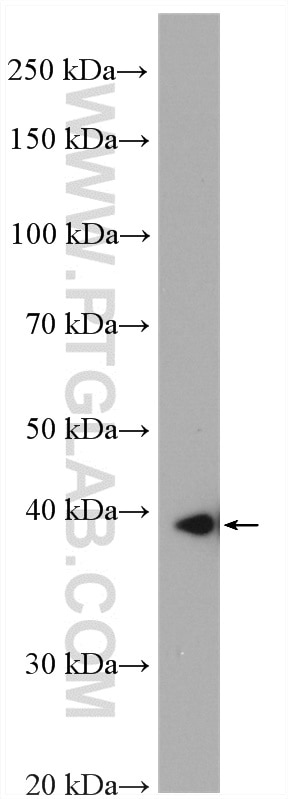 Western Blot (WB) analysis of mouse brain tissue using SLC25A39 Polyclonal antibody (14963-1-AP)