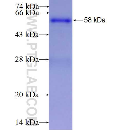 SLC25A39 fusion protein Ag6825 SDS-PAGE
