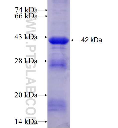 SLC25A39 fusion protein Ag7141 SDS-PAGE
