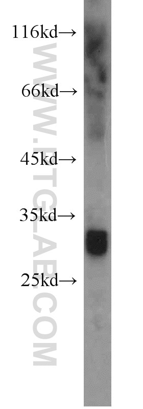 Western Blot (WB) analysis of human heart tissue using ANT1/2 Polyclonal antibody (15997-1-AP)