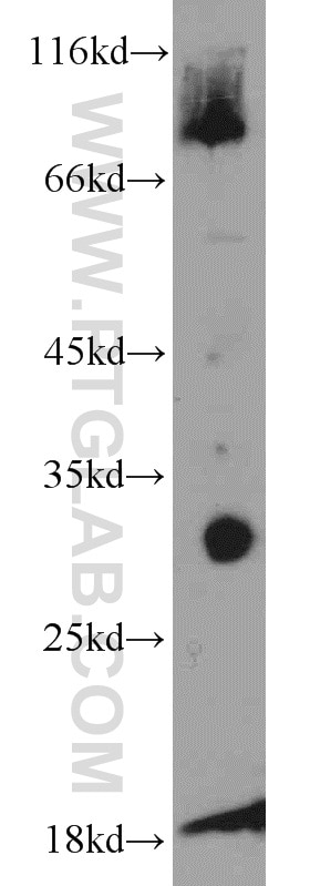 Western Blot (WB) analysis of mouse skeletal muscle tissue using ANT1/2 Polyclonal antibody (15997-1-AP)