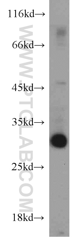 Western Blot (WB) analysis of mouse brain tissue using ANT1/2 Polyclonal antibody (15997-1-AP)