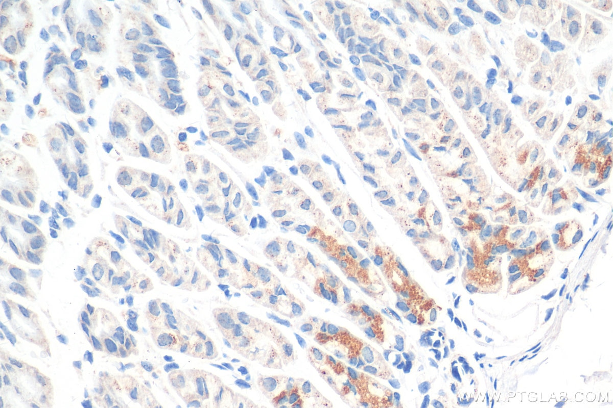 Immunohistochemistry (IHC) staining of mouse stomach tissue using SLC25A4 Polyclonal antibody (30631-1-AP)
