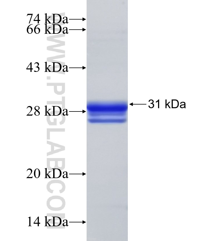 SLC25A4 fusion protein Ag33385 SDS-PAGE