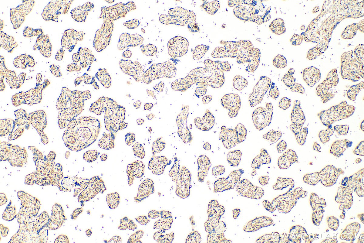 Immunohistochemistry (IHC) staining of human placenta tissue using SLC25A40 Polyclonal antibody (20615-1-AP)