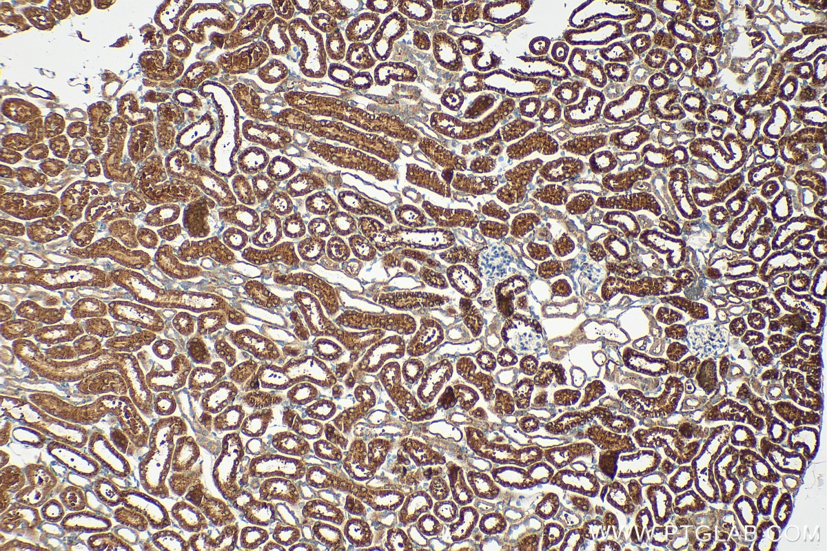 Immunohistochemistry (IHC) staining of mouse kidney tissue using SLC25A40 Polyclonal antibody (20615-1-AP)