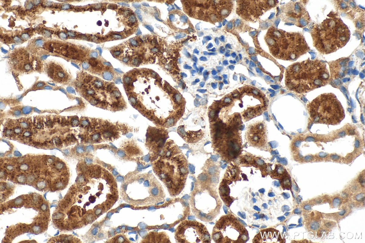Immunohistochemistry (IHC) staining of mouse kidney tissue using SLC25A40 Polyclonal antibody (20615-1-AP)