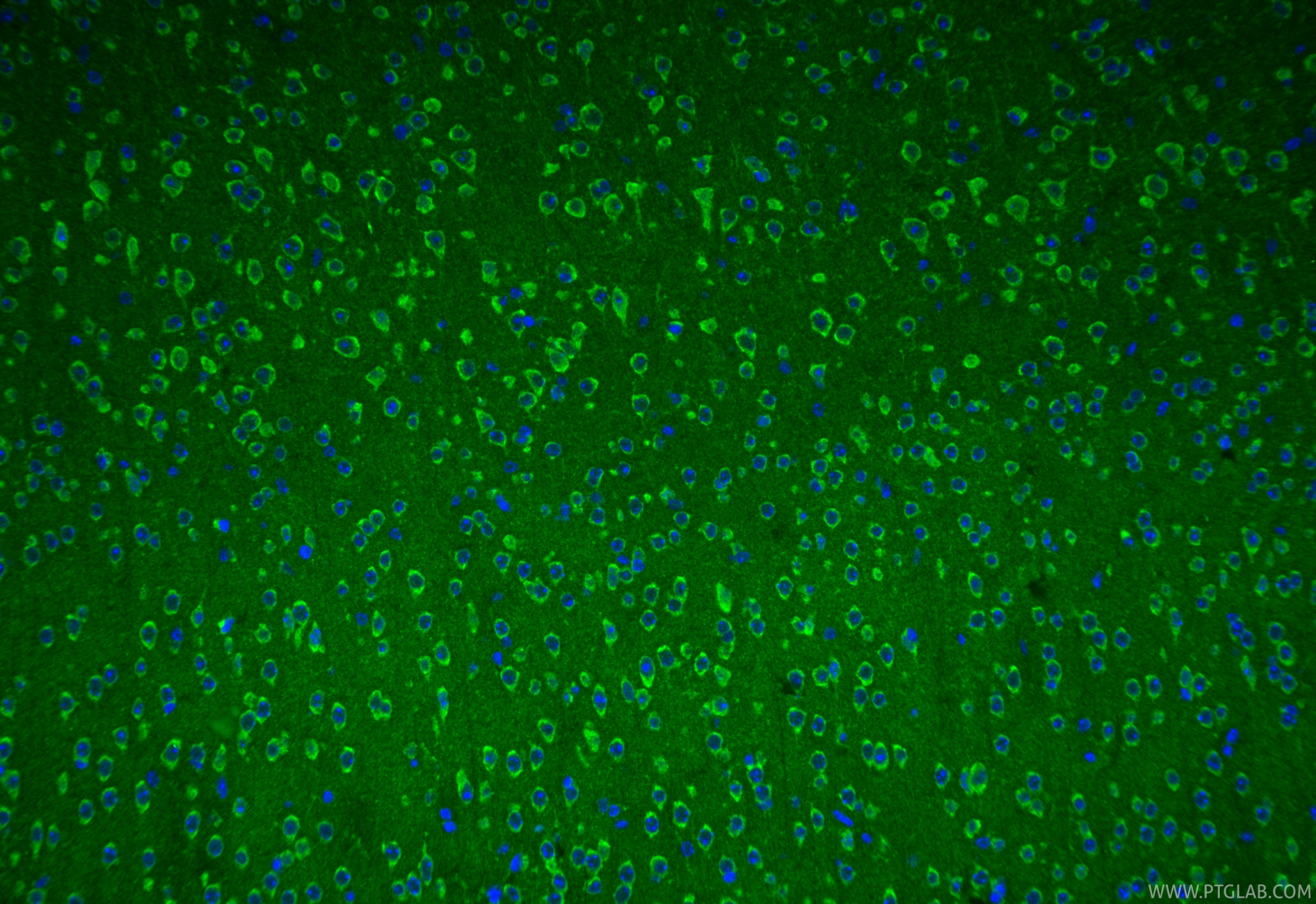 IF Staining of mouse brain using 17437-1-AP Immunofluorescence (IF) / fluorescent staining of mouse brain tissue using SLC25A41 Polyclonal antibody (17437-1-AP)