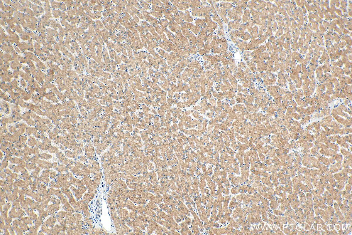 Immunohistochemistry (IHC) staining of human liver tissue using SLC25A41 Polyclonal antibody (17437-1-AP)
