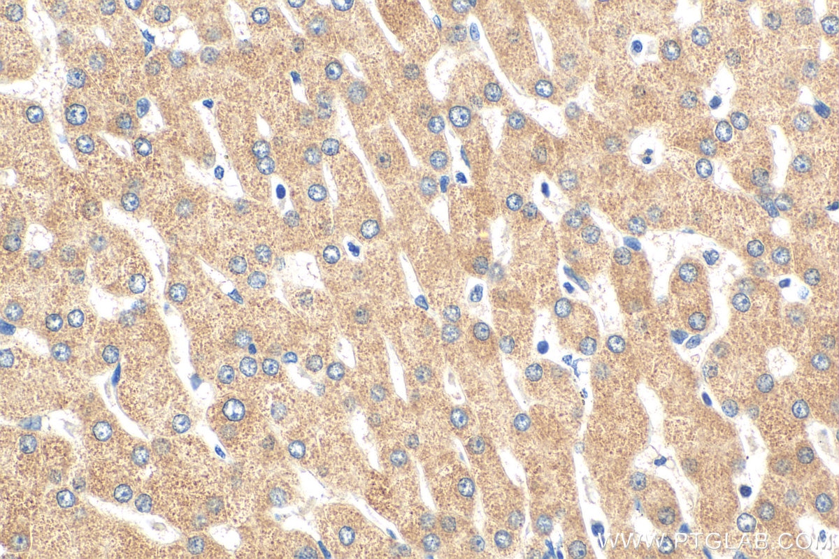 Immunohistochemistry (IHC) staining of human liver tissue using SLC25A41 Polyclonal antibody (17437-1-AP)
