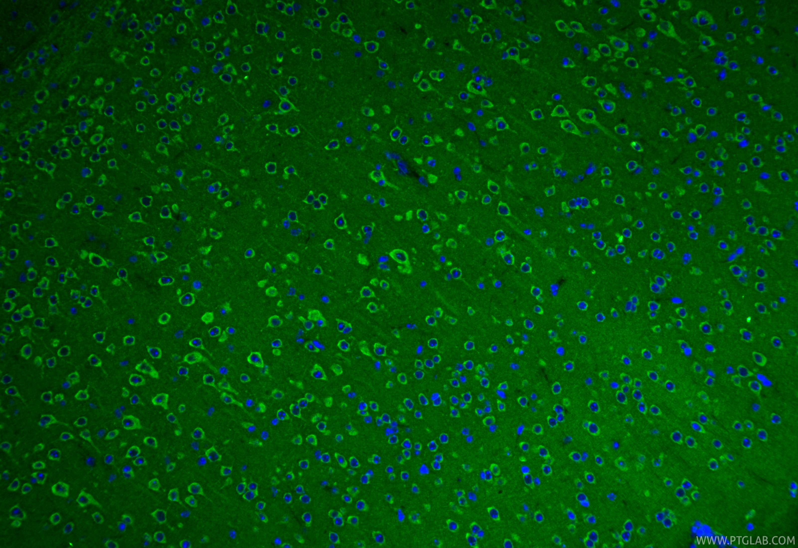 IF Staining of mouse brain using 27720-1-AP Immunofluorescence (IF) / fluorescent staining of mouse brain tissue using SLC25A42 Polyclonal antibody (27720-1-AP)