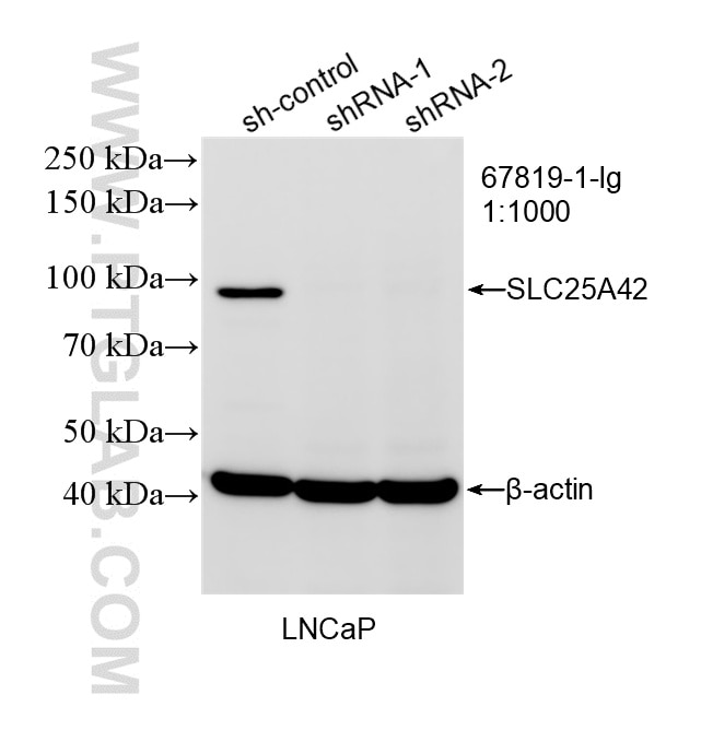 Western Blot (WB) analysis of LNCaP cells using SLC25A42 Monoclonal antibody (67819-1-Ig)