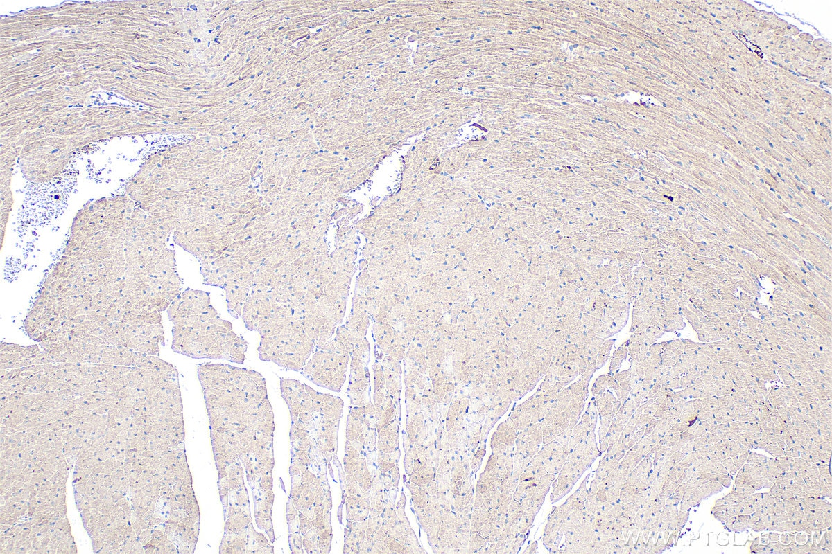 Immunohistochemistry (IHC) staining of mouse heart tissue using SLC25A44 Polyclonal antibody (17540-1-AP)