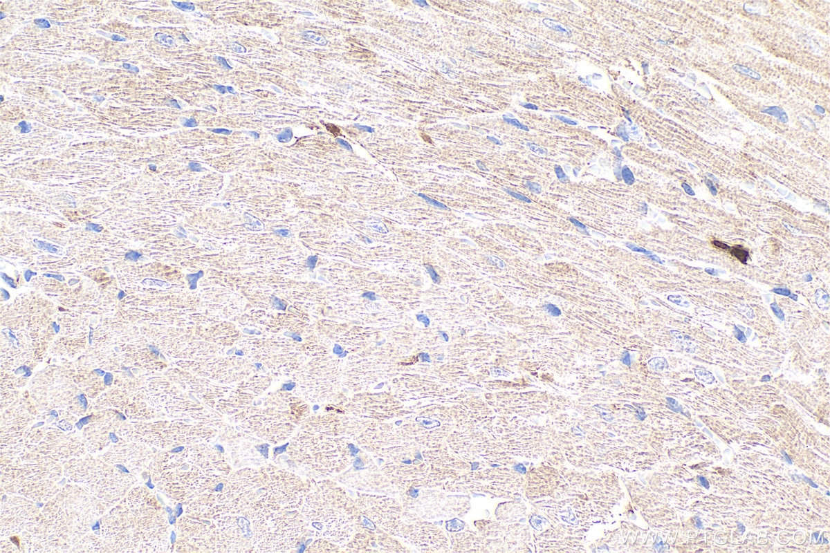 Immunohistochemistry (IHC) staining of mouse heart tissue using SLC25A44 Polyclonal antibody (17540-1-AP)