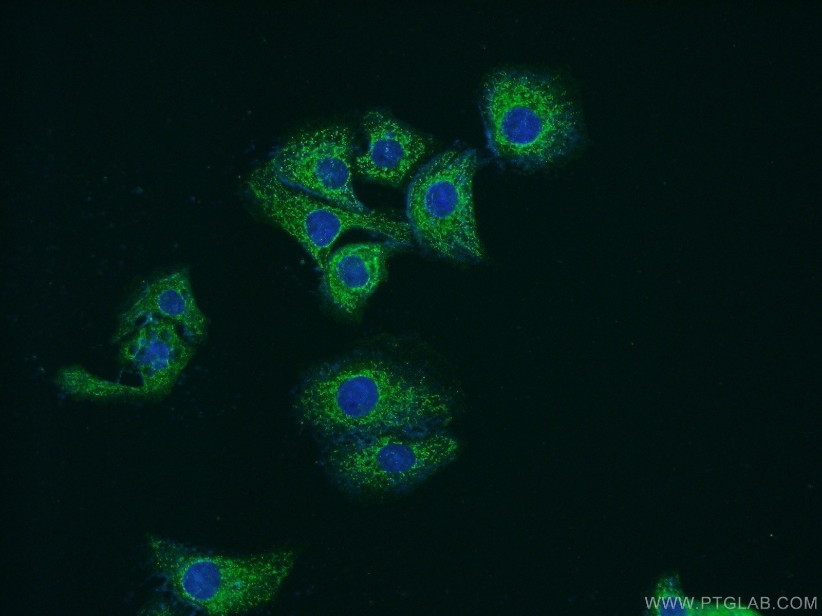 IF Staining of SH-SY5Y using 14160-1-AP