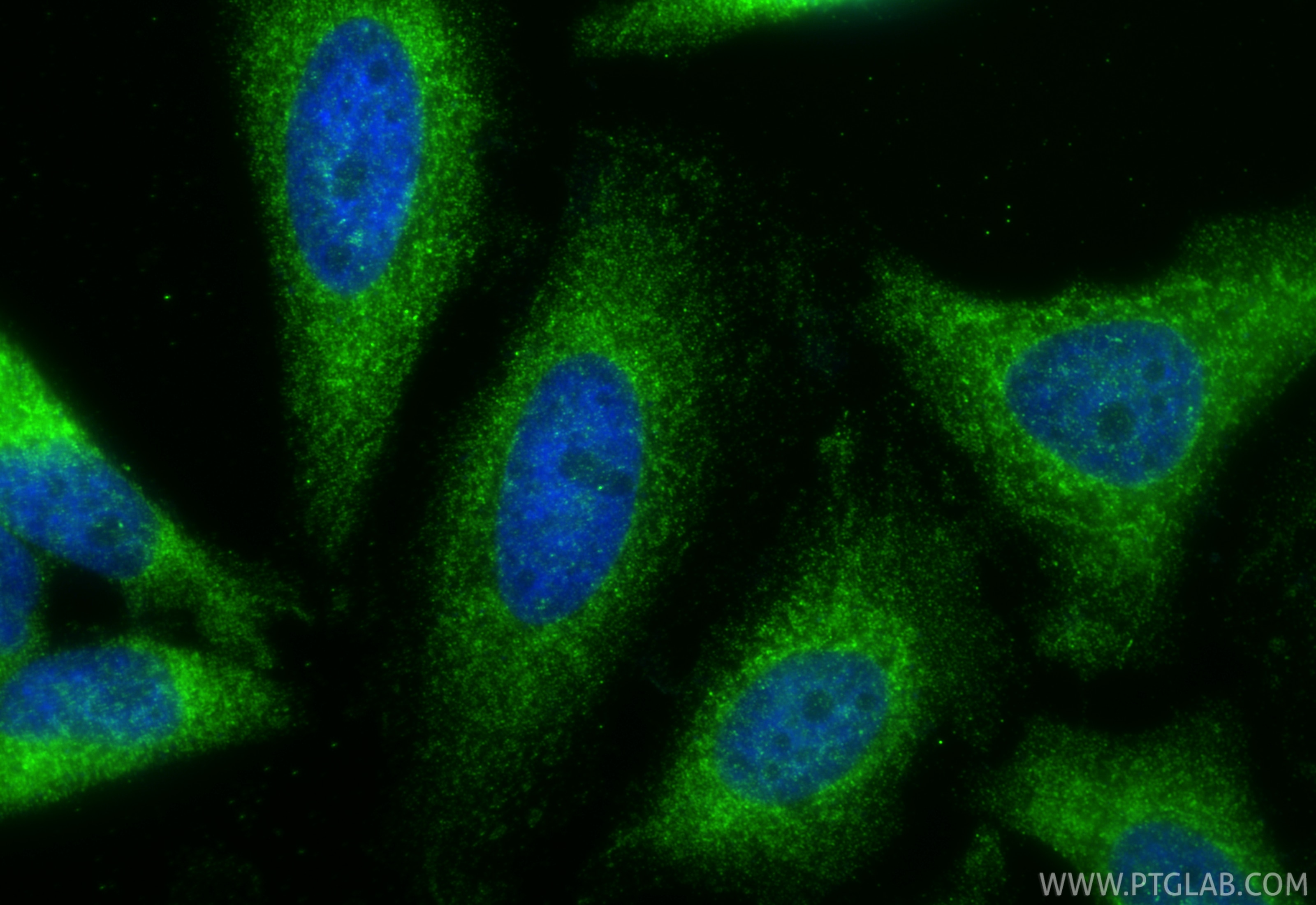 Immunofluorescence (IF) / fluorescent staining of HeLa cells using SLC25A46 Polyclonal antibody (12277-1-AP)